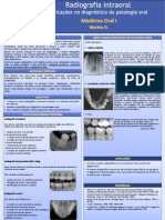 Radiografia Intra-Oral: Aplicações No Diagnóstico de Patologia Oral