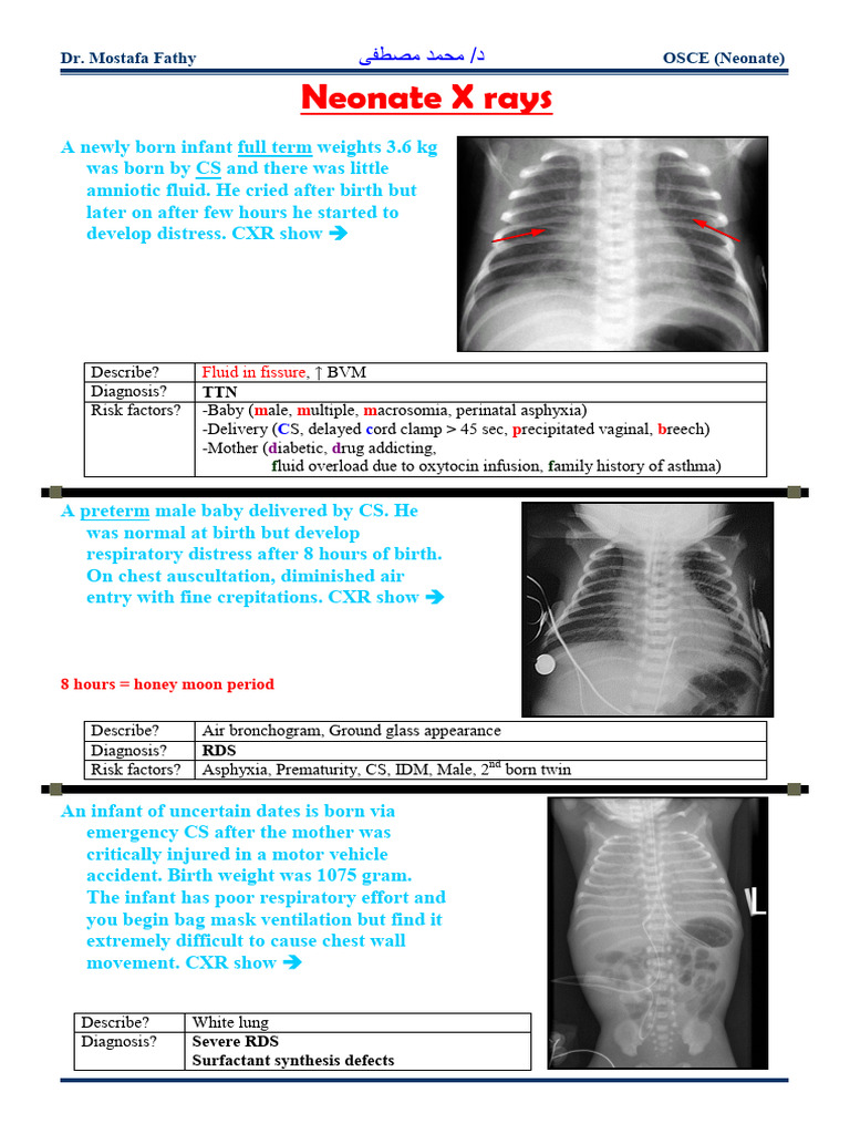 Neonatal Respiratory Distress Diagnosis Guide | PDF | Human Diseases ...