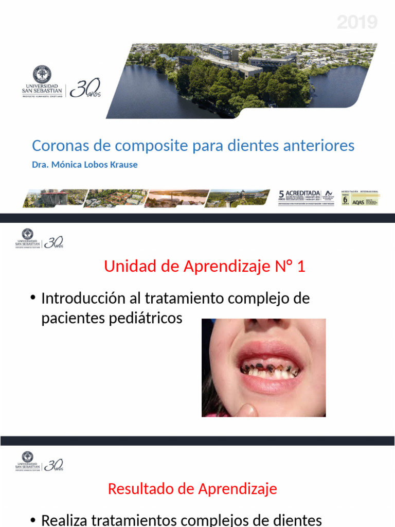 2-Clase Coronas de Composite 2019 | PDF | Compuesto Dental | Diente