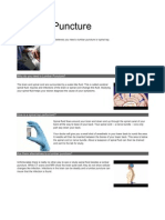 Lumbar Puncture