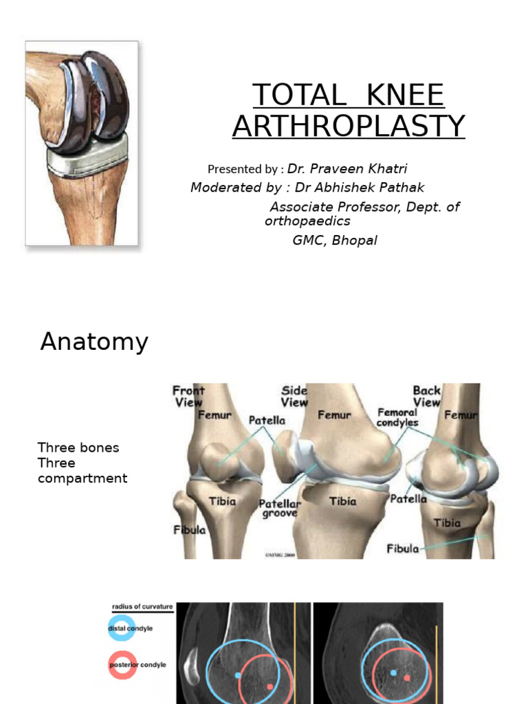 Total Knee Arthroplasty Overview | PDF | Knee | Joints