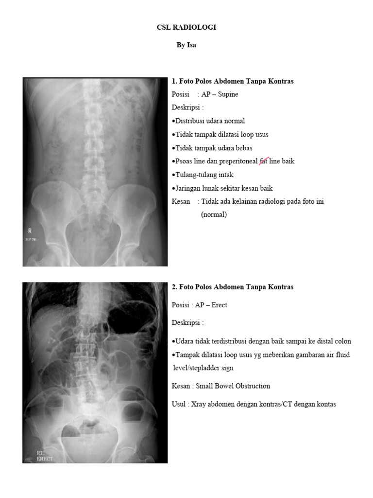 Analisis Radiologi Abdomen dan Thorax | PDF