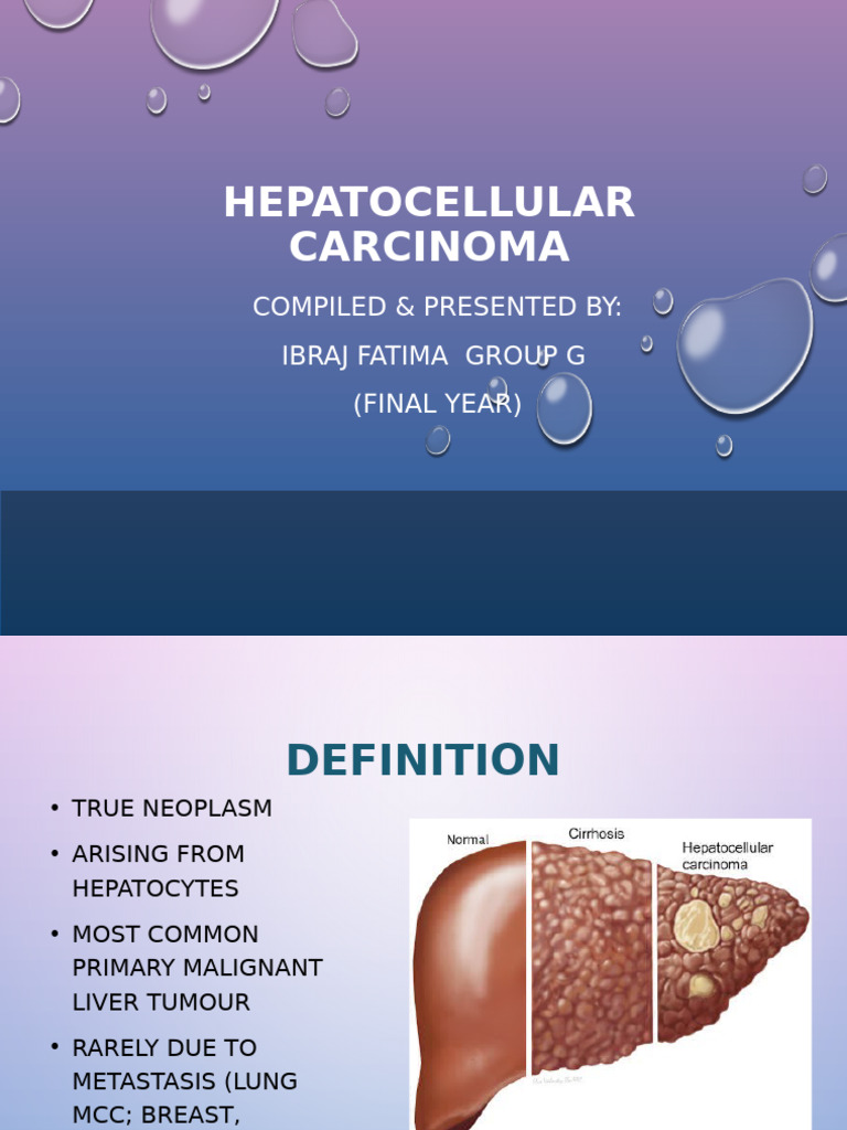 Understanding Hepatocellular Carcinoma | PDF | Cirrhosis | Liver