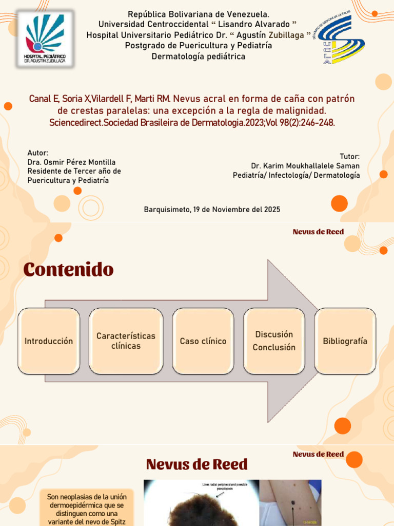 nevo de reed | PDF | Melanoma | Medicina