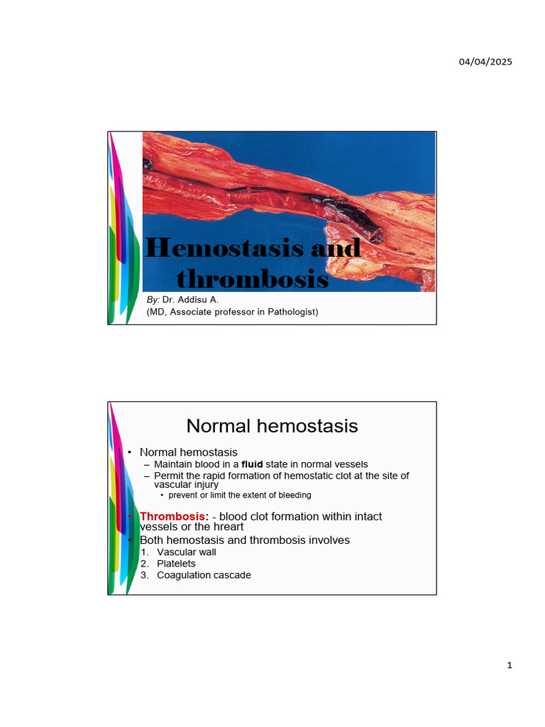 5.1hemostasis and Thrombosis and Shock | PDF | Coagulation | Thrombus