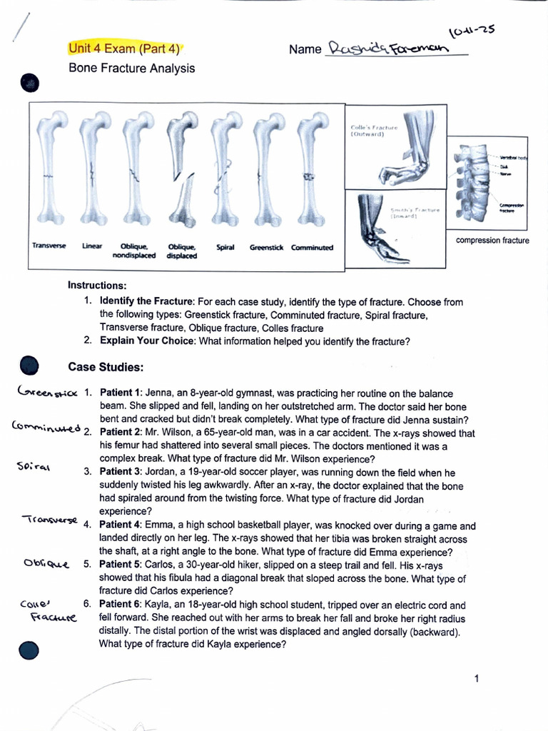 Bone Fracture Identification Guide | PDF | Musculoskeletal System ...