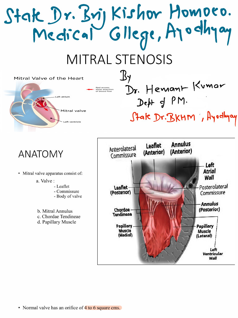 Parachute Mitral Valve and Tapping Apex Beat | PDF | Heart | Heart Valve