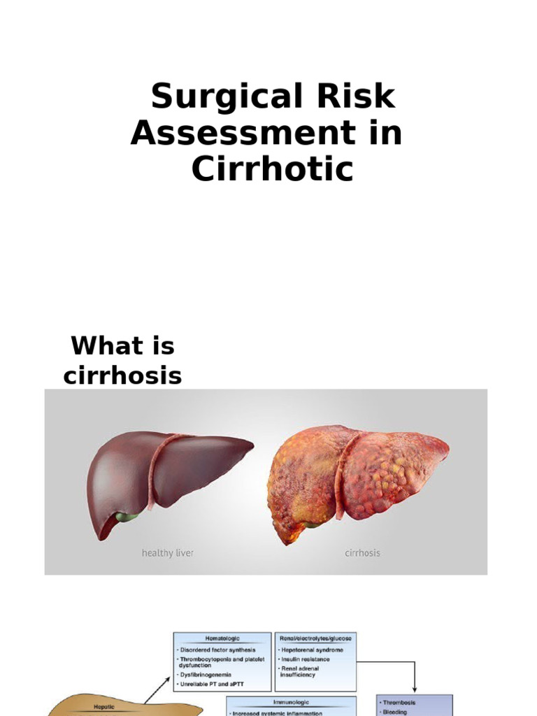 Surgical Risk in Cirrhosis Patients | PDF