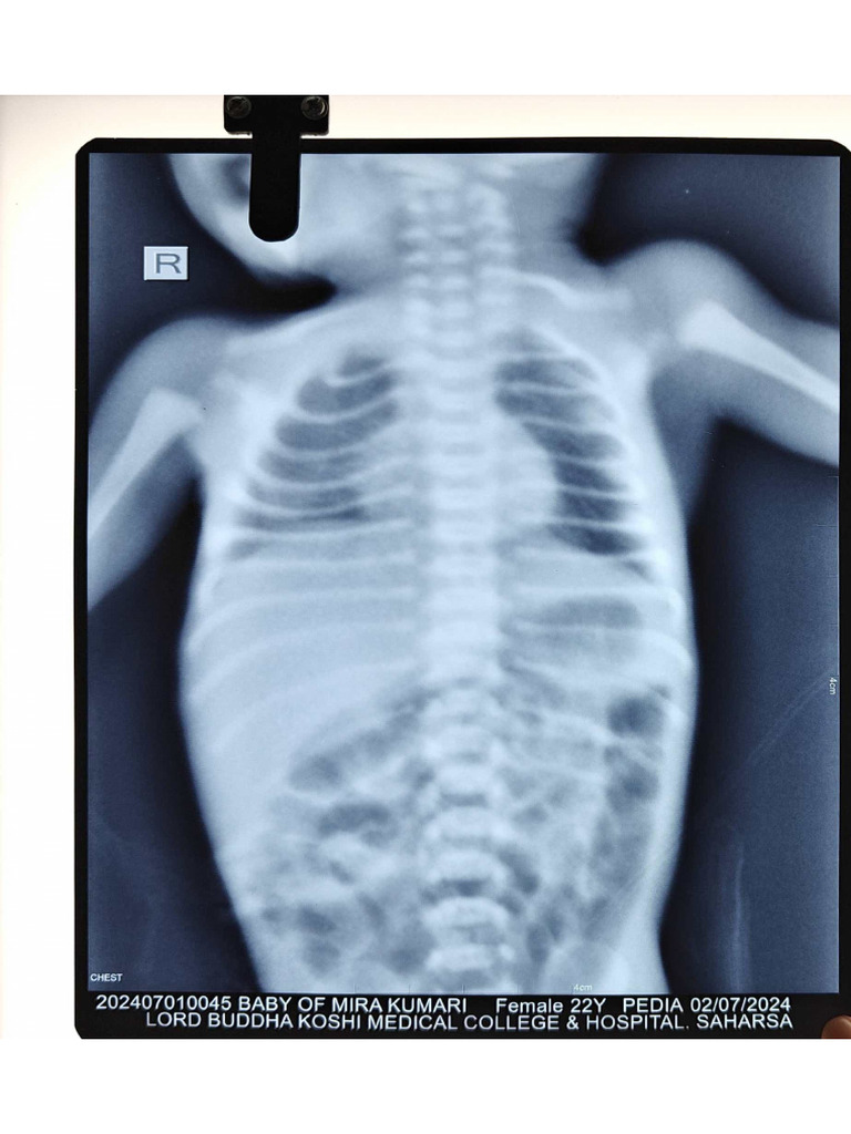 Pedia Xray | PDF
