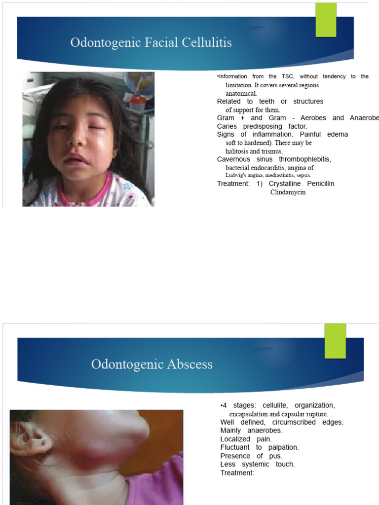 Odontogenic Facial Cellulitis | PDF | Immunology | Human Diseases And ...