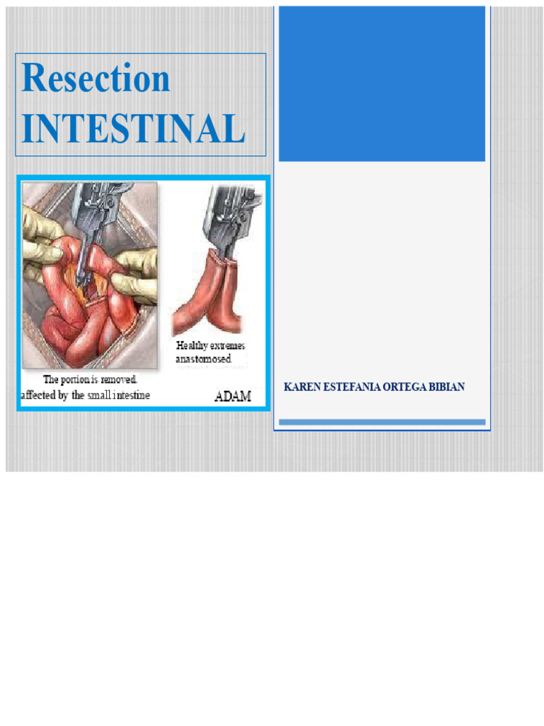 Intestinal Resection TODAY'S PRESENTATION | PDF | Gastrointestinal ...