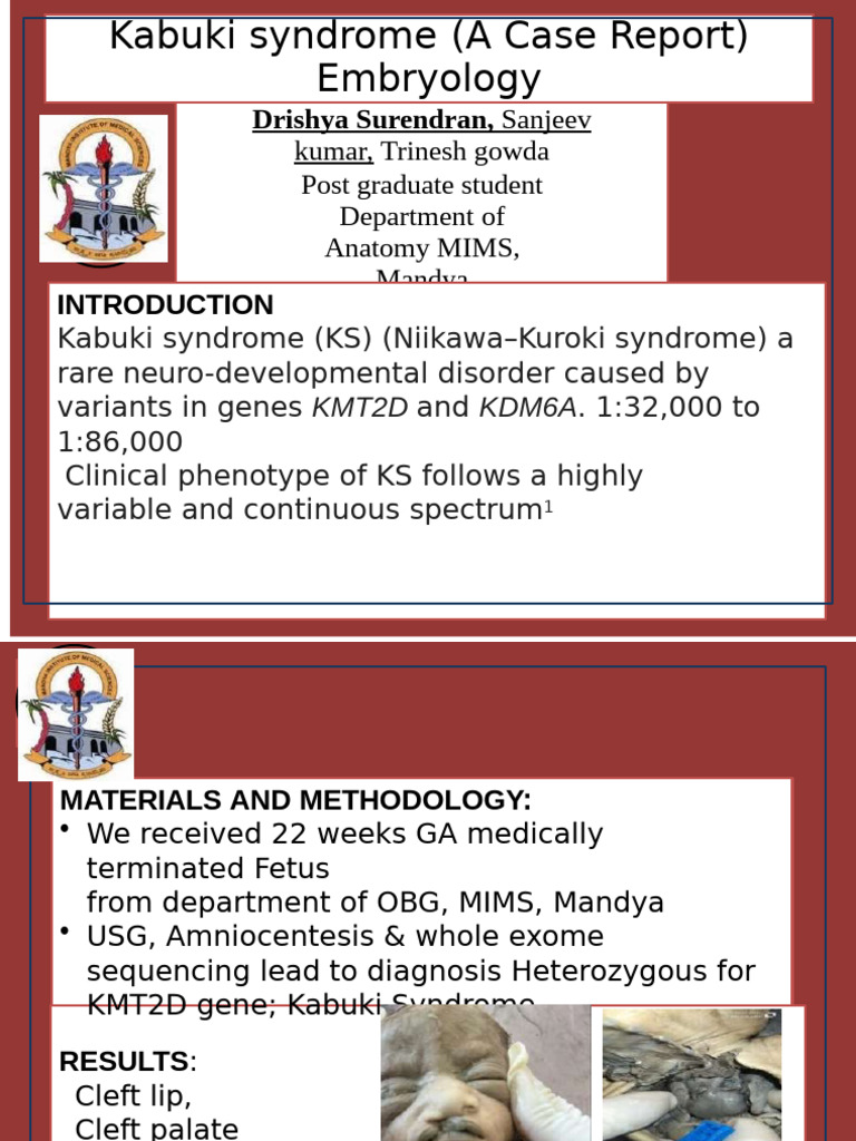 Kabuki Syndrome Case Report Analysis | PDF