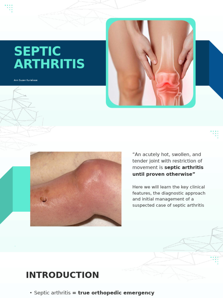 Septic Arthritis: Diagnosis & Management Guide | PDF | Arthritis ...