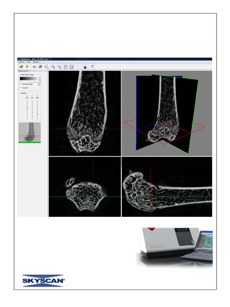 Skyscan 1174 Bone Morphometry | PDF | Computer Graphics | Computer Vision
