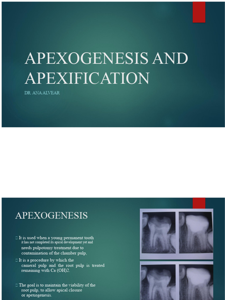 Apexogenesis and Apexification Guide | PDF | Dentistry | Dentistry Branches