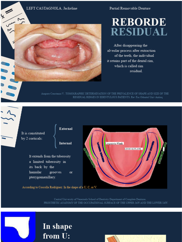 Types of Residual Ridges in Edentulous Patients | PDF | Dentures ...