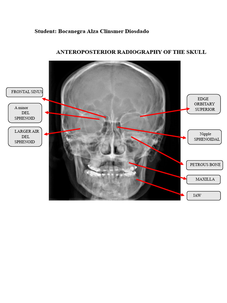 Skull X-Ray, Magnetic Resonance, CT | PDF