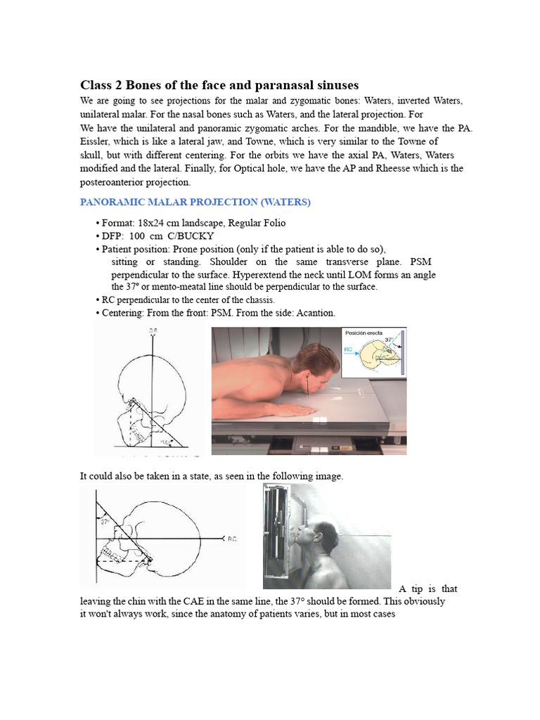 Facial Bones and Sinus X-ray Projections | PDF | Skull | Primate Anatomy
