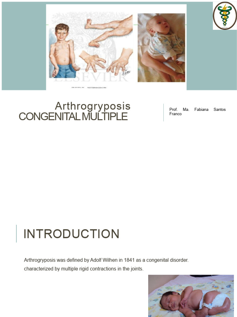 understanding-arthrogryposis-causes-care-pdf-clinical-medicine