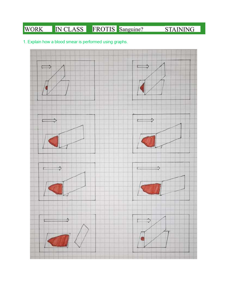 Blood Smear Techniques and Errors | PDF | Staining | Cell Biology