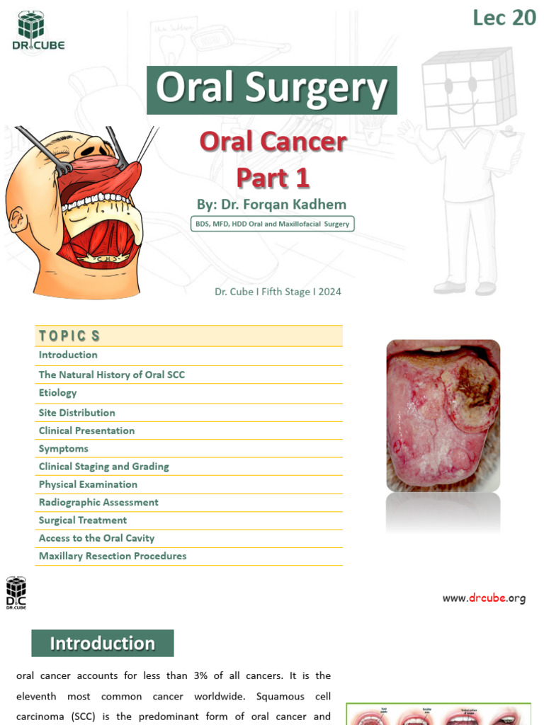 Oral Cancer Overview and Treatment Guide | PDF | Cancer | Carcinogenesis