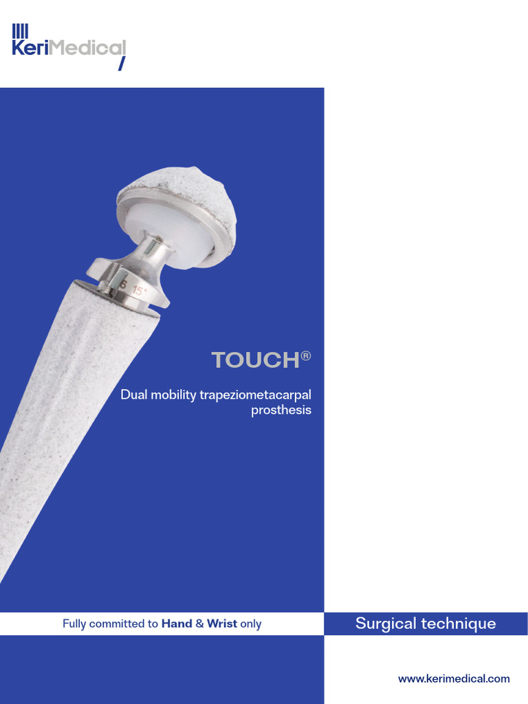 Dual Mobility Trapeziometacarpal Prosthesis Guide | PDF ...