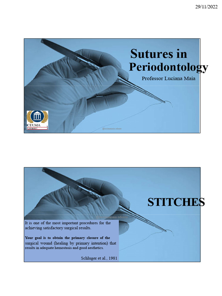 Suturing Techniques in Periodontology | PDF | Surgical Suture | Medical ...