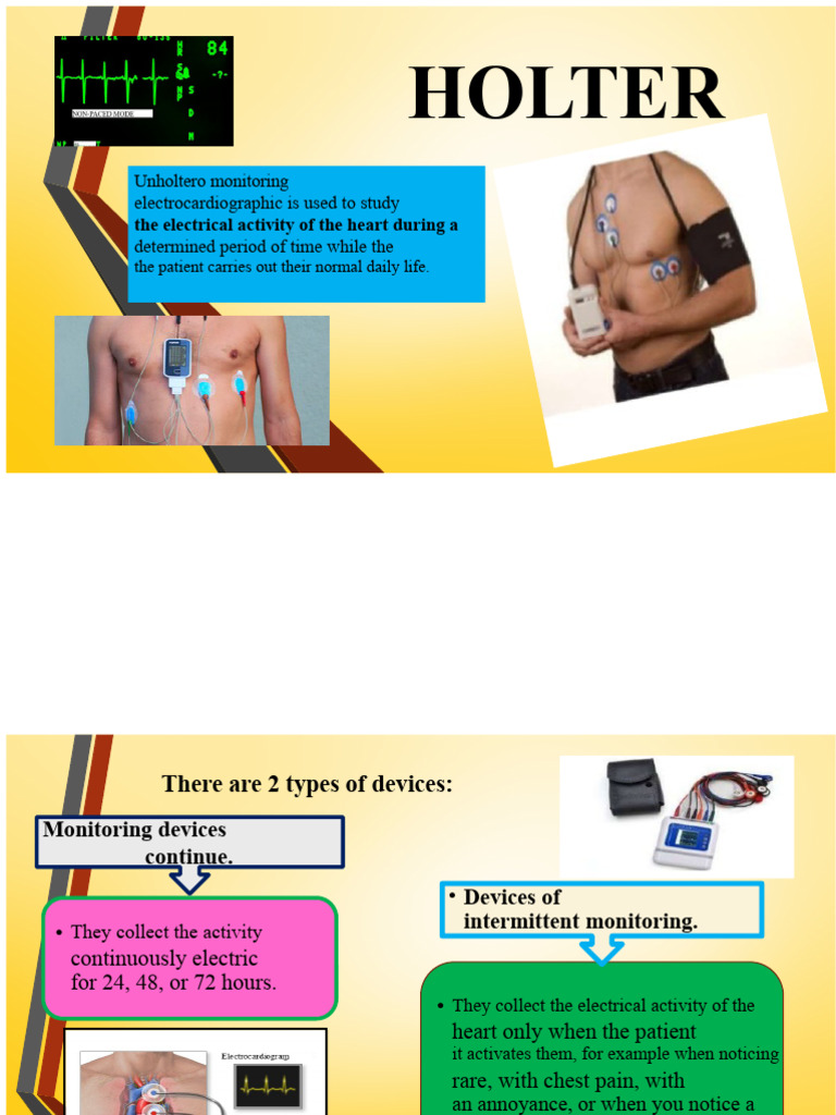 HOLTER | PDF | Electrocardiography | Diseases And Disorders