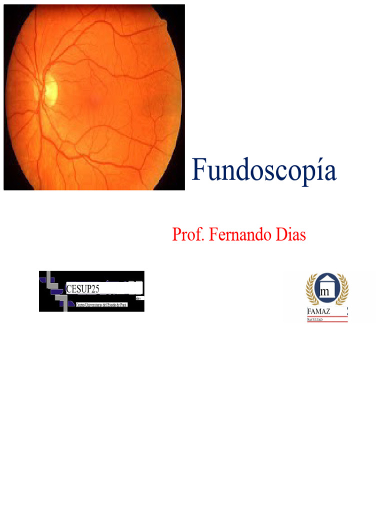 Fundoscopía: Examen del Fondo de Ojo | PDF | Ojo humano | Ojo