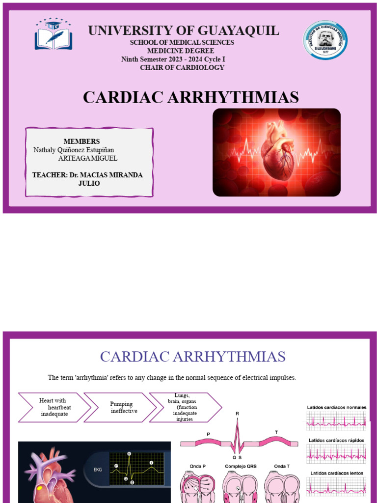 Presentation of Cardiac Arrhythmias | PDF | Electrocardiography | Heart