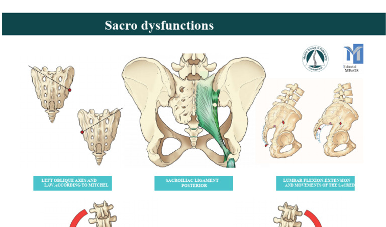 Sacroiliac Dysfunction and Movement | PDF