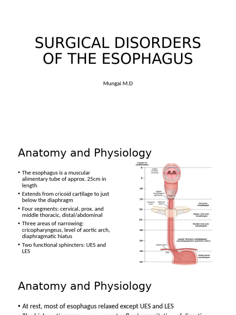 Surgical Disorders of The Esophagus New | PDF | Gastroesophageal Reflux ...