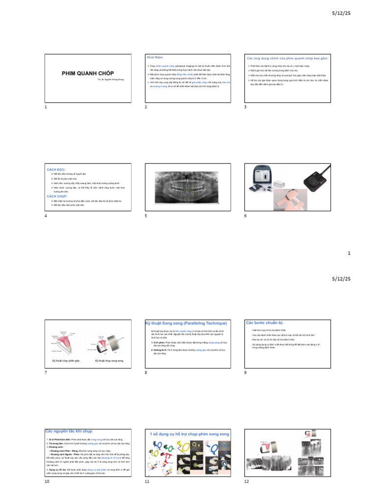 Phim Quanh Chóp | PDF