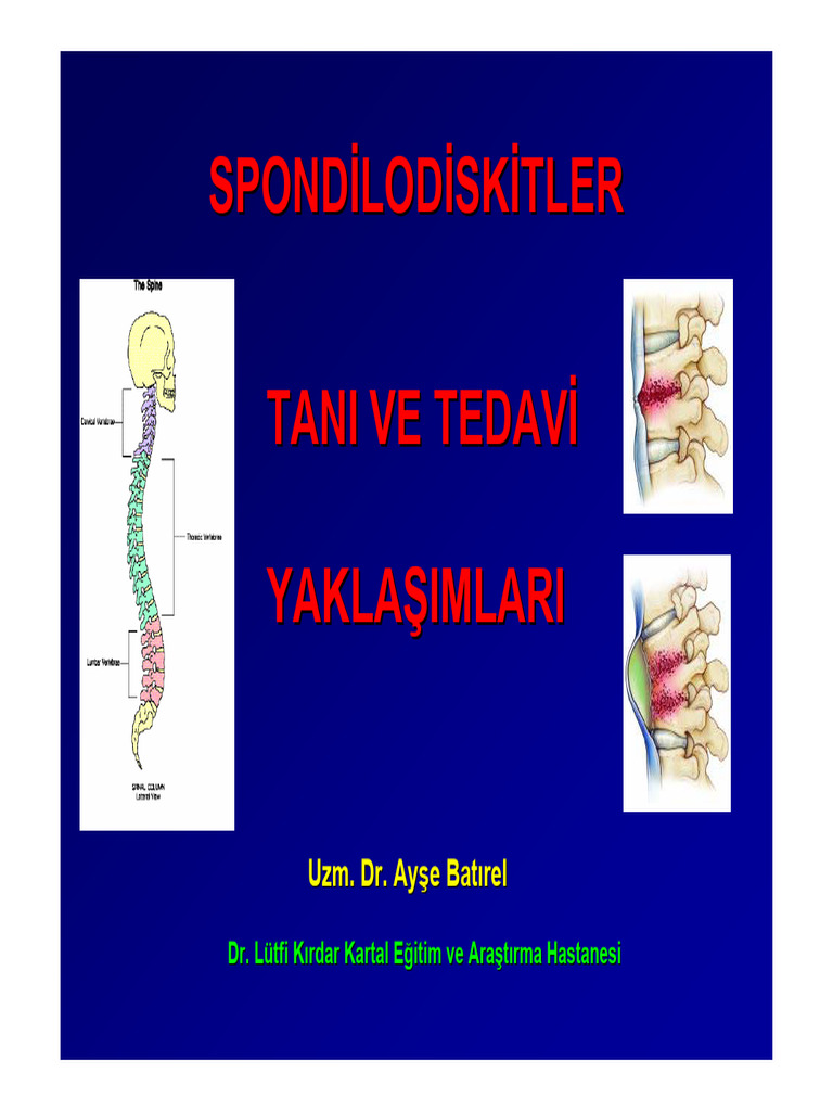 Spondilo | PDF
