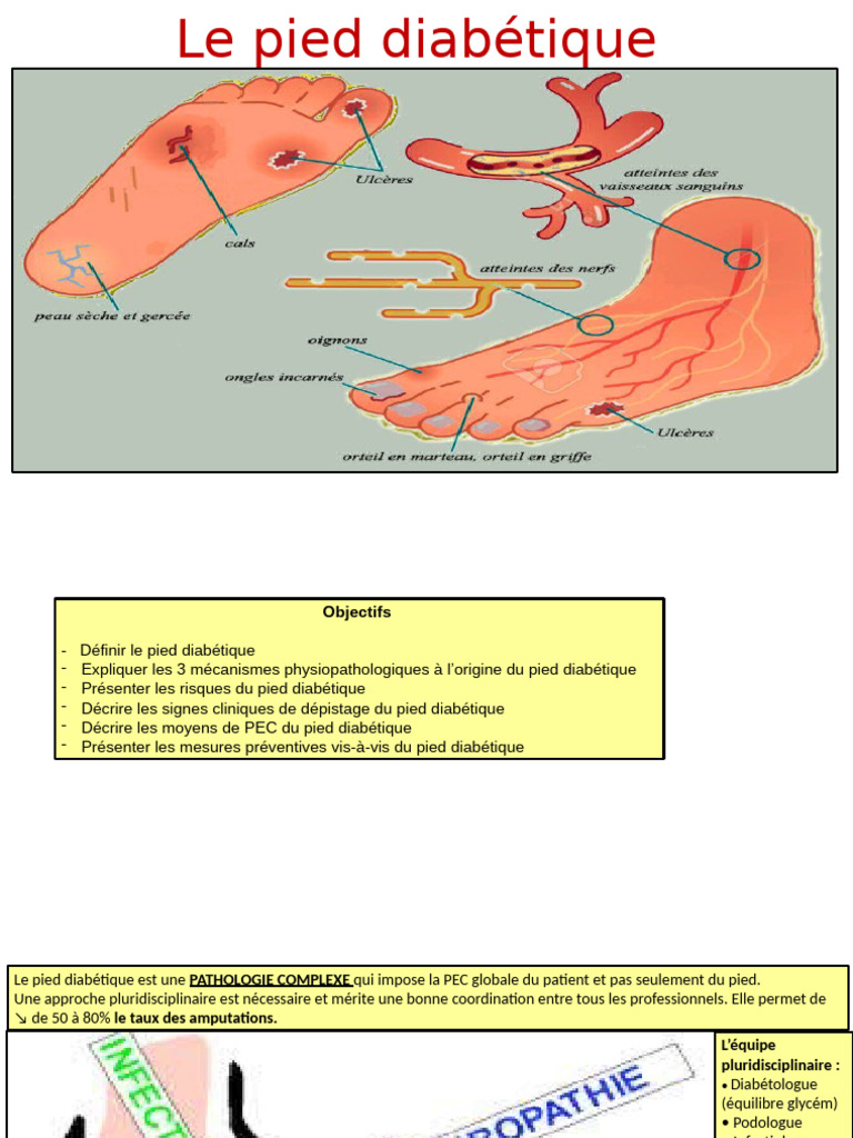 Comprendre le pied diabétique : causes et soins | PDF | Spécialités ...