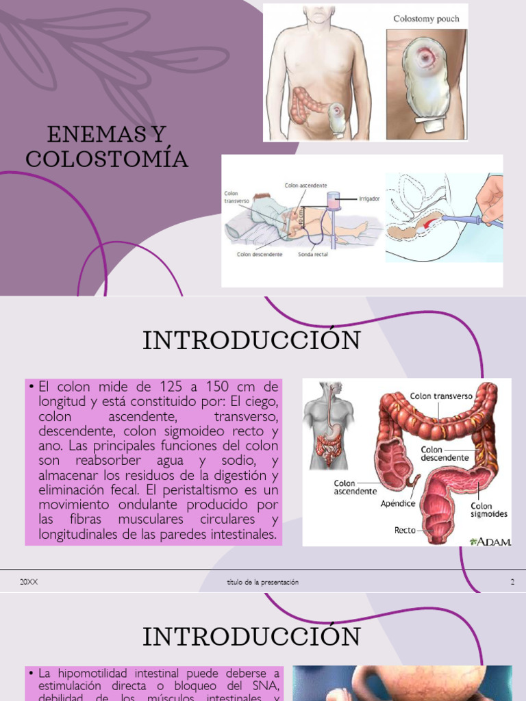 Enemas y Ostomías: Guía Completa | PDF | Intestino grueso | Tracto ...