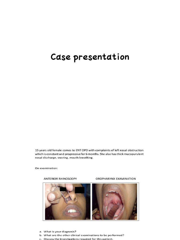 Right Antrochonal Polyp Case Study | PDF | Human Nose | Ear