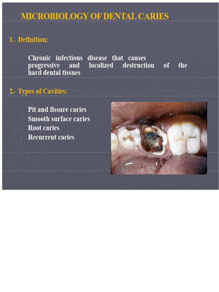 Microbiology of Dental Caries | PDF | Human Tooth | Microbiology