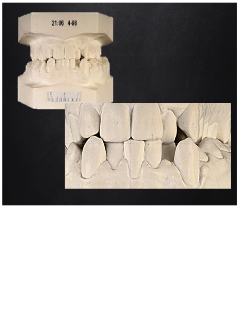 Dental Discrepancy Analysis Methods | PDF | Tooth | Orthodontics