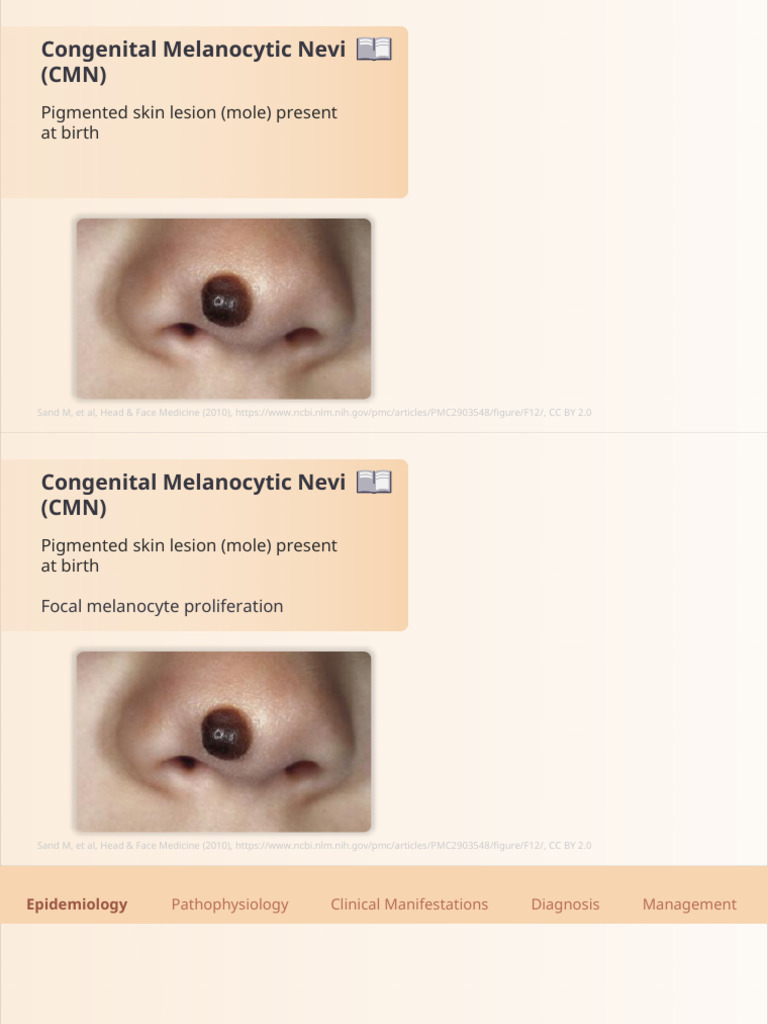 Slides Congenital Melanocytic Nevi Dermatopathology | PDF