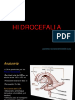 Hidrocefalia Expo