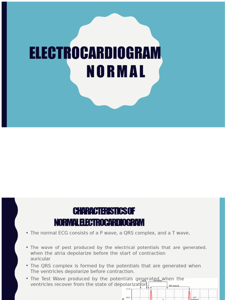 Understanding Normal Electrocardiograms | PDF | Electrocardiography ...