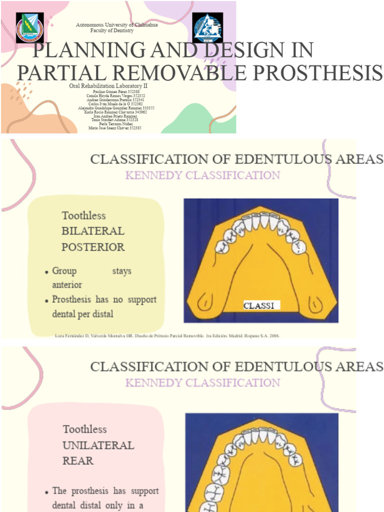 Planning and Design in Removable Partial Prosthesis | PDF | Prosthesis ...