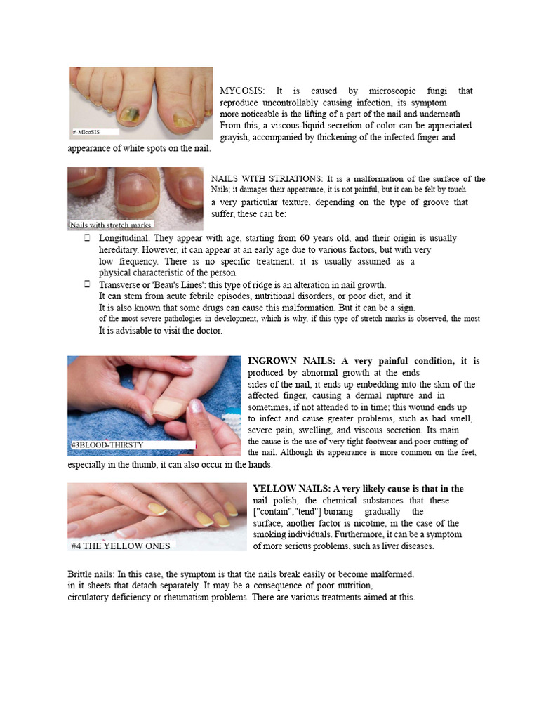 nail diseases | PDF | Nail (Anatomy) | Human Diseases And Disorders