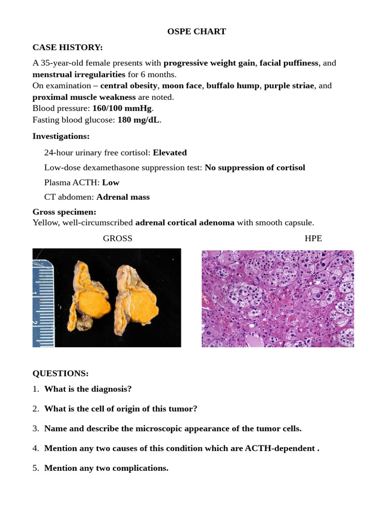 Cushing Syndrome Case Study Analysis | PDF