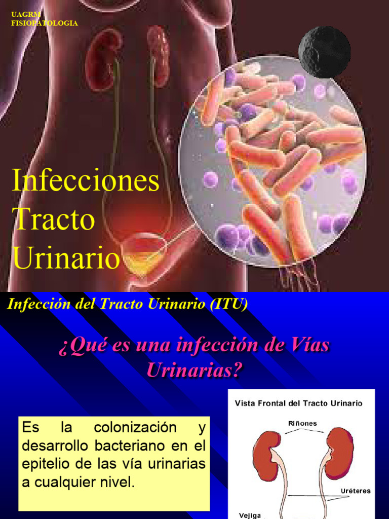 Infección del Tracto Urinario: Causas y Tratamiento | PDF | Infección ...