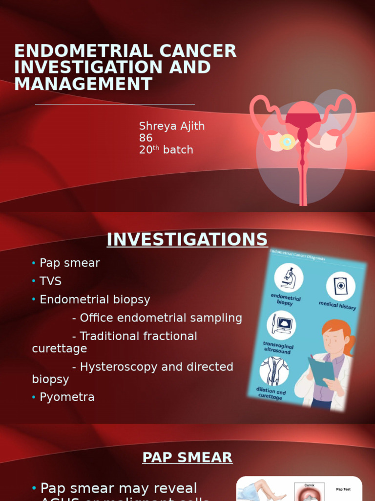 Endometrial Cancer | PDF | Biopsy | Medical Specialties