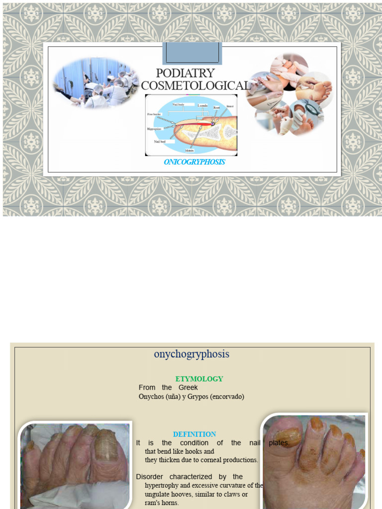 Most Common Podiatric Pathologies Onychogryphosis | PDF