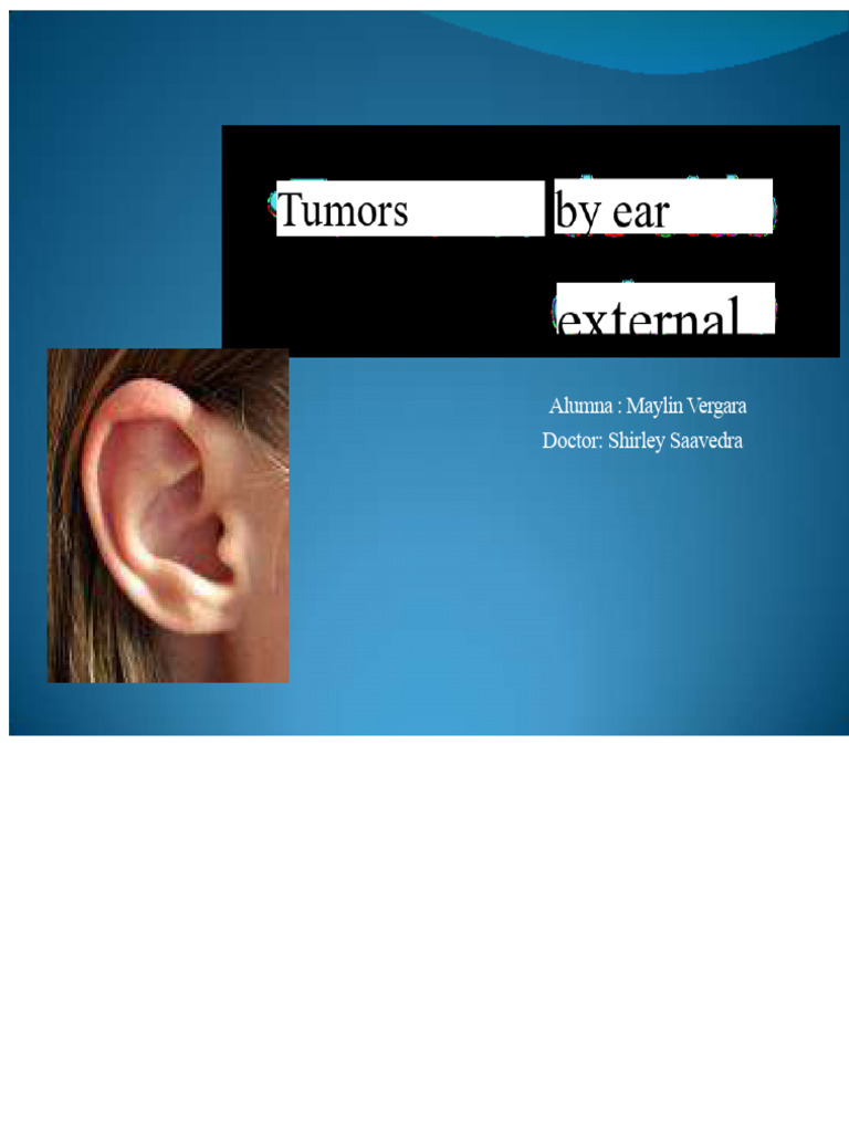 Ear Cysts and Tumors: Symptoms & Treatment | PDF | Ear | Neoplasms