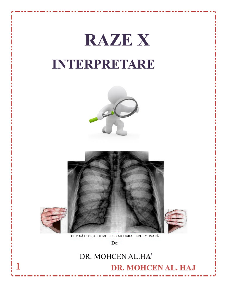 Interpretarea Raze X PDF | PDF
